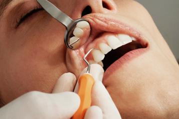 Close-up of a woman's teeth being examined by a dentist